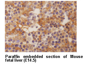 Anti-Dlk (Pref-1) mAb (Clone: 24-11) [Catalog No.: MBL-D187-3]