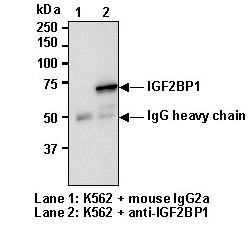 Anti-IGF2BP1 (IMP1) (Human) mAb (Clone: 6H6) [Catalog No.: MBL-RN001M]
