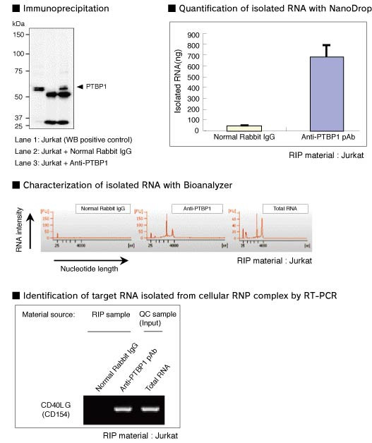 RIP-Assay Kit [Catalog No.: MBL-RN1001]