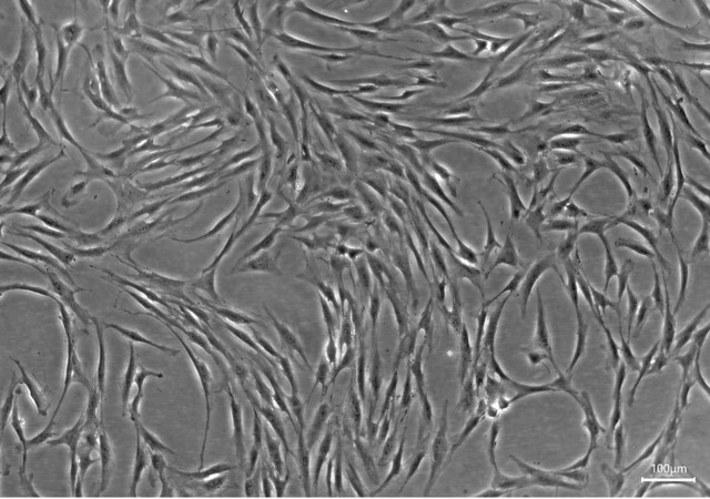 Human Bone Marrow Derived Mesenchymal Stem Cells (Low Passage) - Cosmo ...
