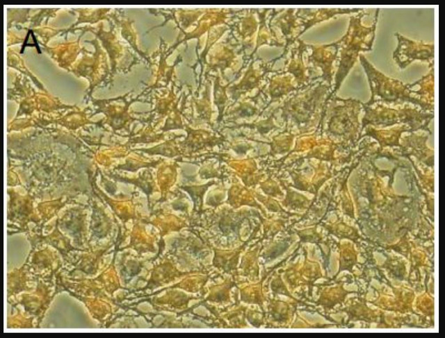 pmc-gist01c_gist-t1-cell-