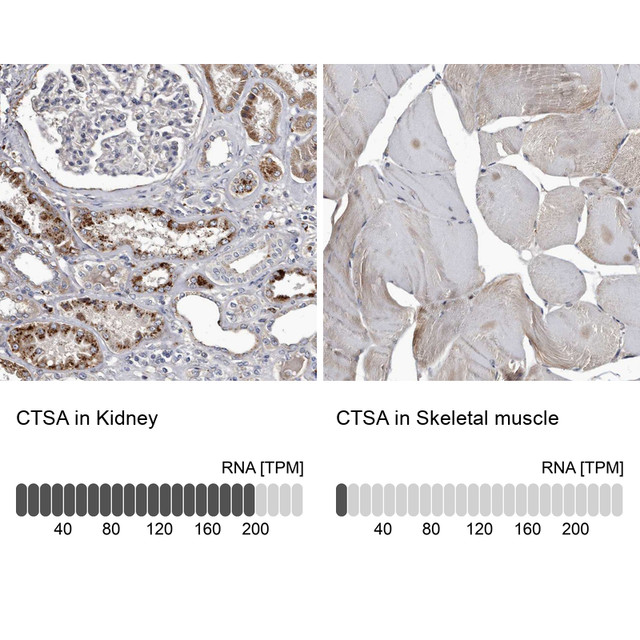 Anti CTSA pAb [Catalog No.: ATL-HPA031068]