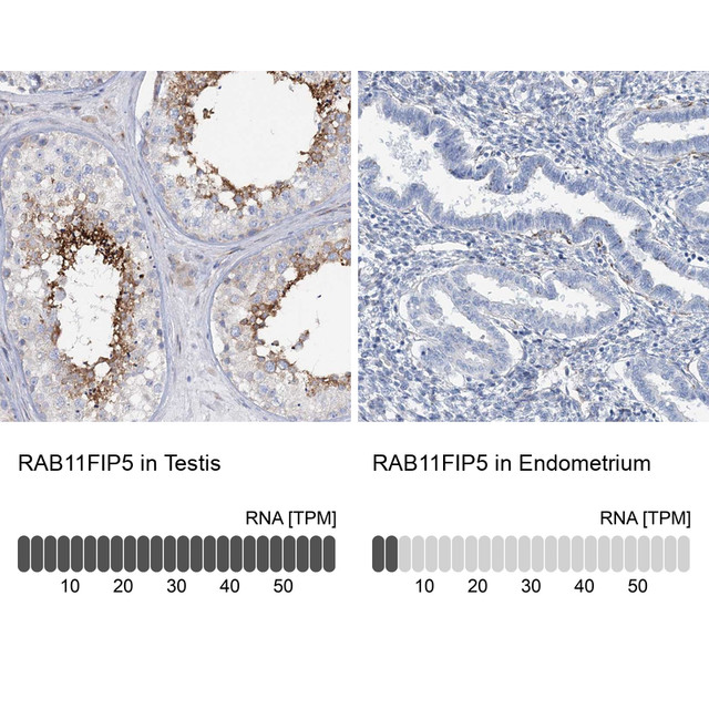 Anti RAB11FIP5 pAb [Catalog No.: ATL-HPA036407]