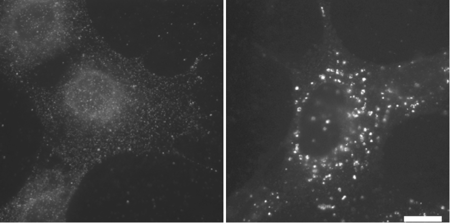 たくと様3 Anti LC3 mAb Antibody (Clone LC3-1703) [Catalog No.: CAC-CTB-LC3-2-IC]