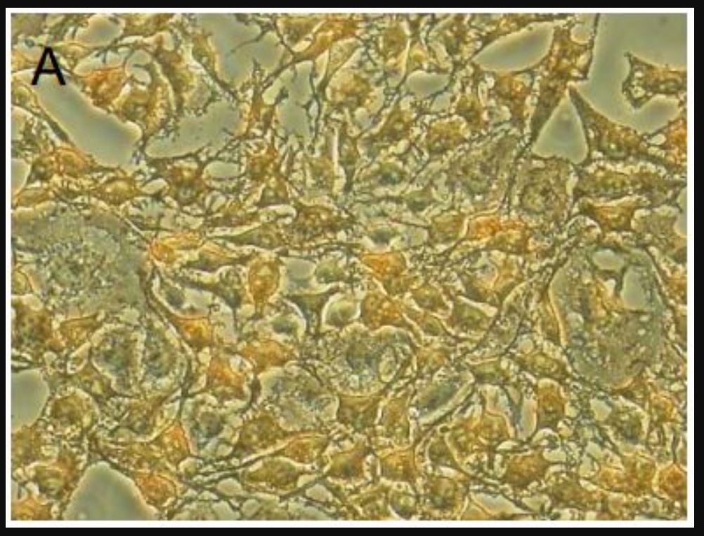 GIST-T1 Cell Line [Catalog No.: PMC-GIST01C]