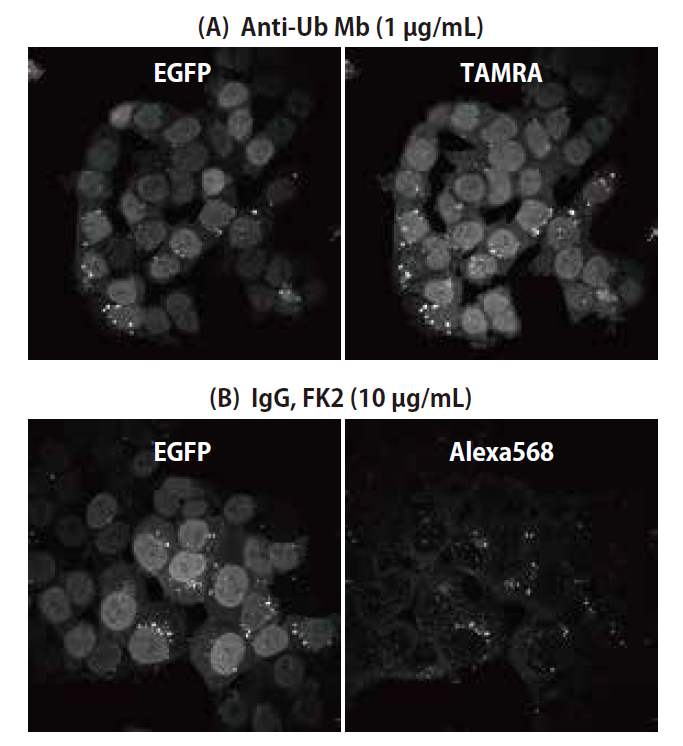 cac-panubiquitin-ihc-01-mb-001-b.png