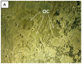 csr-bra-osteoclast-micrograph