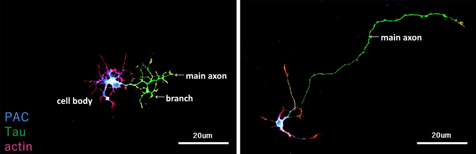 hpk-neuron.jpg