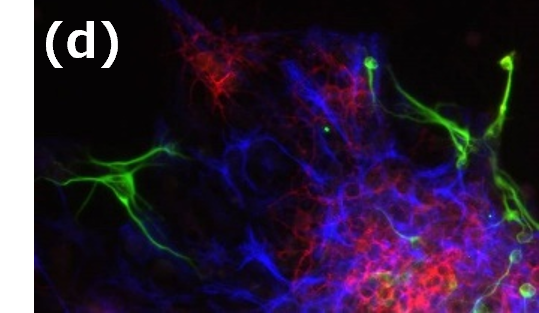 kjn-neural-stem-cell-02d.png