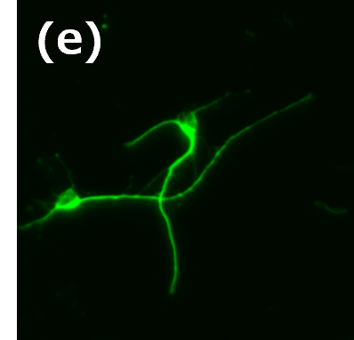 kjn-neural-stem-cell-02e.png