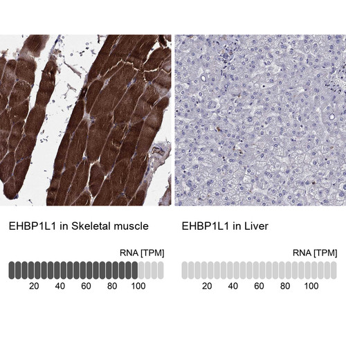 Anti EHBP1L1 pAb [Catalog No.: ATL-HPA073476]