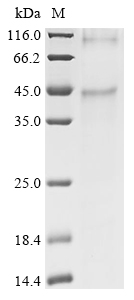 Recombinant Human Medium-wave-sensitive opsin 1(OPN1MW) (CSB-CF016352HU)