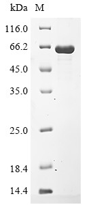 Recombinant Porphyromonas gingivalis Lys-gingipain W83(kgp),partial ...