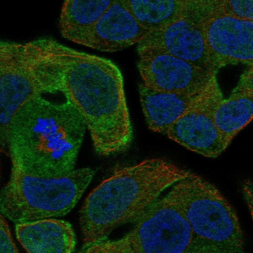 Pab Rabs Anti-RAB25 pAb (ATL-HPA010940)