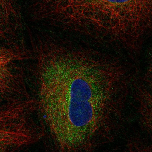 Anti-FADS2 pAb (ATL-HPA079284)
