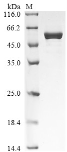 Recombinant Musa acuminata UTP--glucose-1-phosphate uridylyltransferase ...