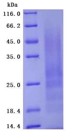 Recombinant Human Myosin regulatory light polypeptide 9 (MYL9) (Active ...