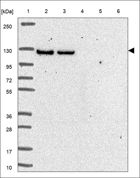 Anti DIP2A pAb (ATL-HPA059614-100) - Cosmo Bio USA