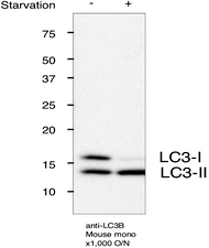 Immunoblot for LC3B.  MEFs +/- starvation for 2 hr SDS-PAGE (MEF lysate 15 ug/lane, 15% gel) Transfer to PVDF membrane (semi-dry blotter, 100 mA/gel 1hr) Expose ECL 5min