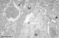 Figure 2. Immuno-electron microscopy analysis of mouse embryonic fibroblasts (MEFs).  MEFs were cultured in DMEM without amino acids for 2 hr. After fixation with 4% paraformaldehyde for 2 hr at room temperature, they were permeabilized with liquid nitrogen. Immuno-electron microscopy analysis (pre-embedding method) of endogenous LC3 was performed using #1703 anti-LC3 antibody at 1:10 dilution. The gold labeling was intensified by using a silver enhancement kit (HQ silver enhancement kit, Nanoprobes, NY).