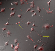 Localization of phospholipid OPPC to the neurite tip (red) in cultured rat PC12 neurons using clone 15-3C1.
