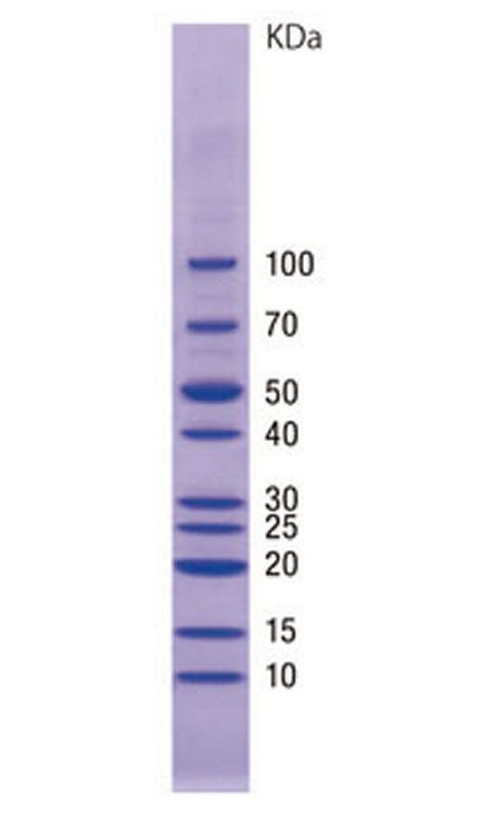 using unstained protein ladder western blot