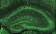 Figure 1. Immunohistochemistry of formalin/PFA-fixed paraffin embedded sections stained with Anti Dysbindin-1 antibody.