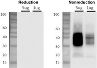 Figure 1. Generic exosome shown with commonly associated molecules. Not all molecules will be found with any given exosome and other molecules may also be found.