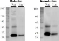 Figure 2. Western blot analysis of CD81 in C32 melanoma cell exosomes with anti-CD81 (12C4) antibody. Sample 1. C32 cell Exosome (5ug, 1ug)  2. Primary antibody: anti-CD81 (12C4) (1ug/mL)  3. Secondary antibody: anti-mouse IgG-HRP