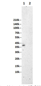 Anti EpCAM