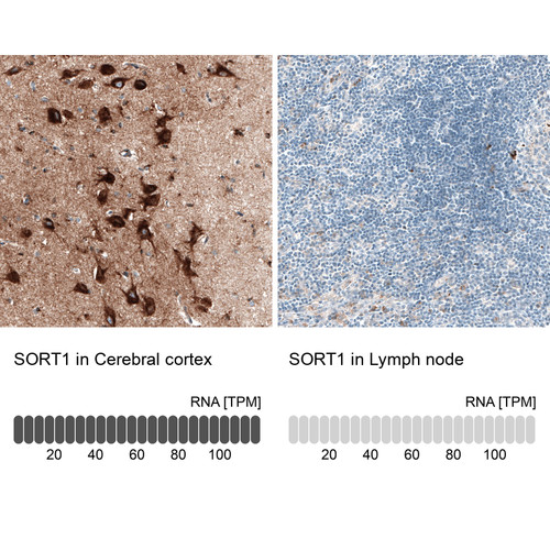 Anti SORT1 mAb [Catalog No.: ATL-AMAb91427]