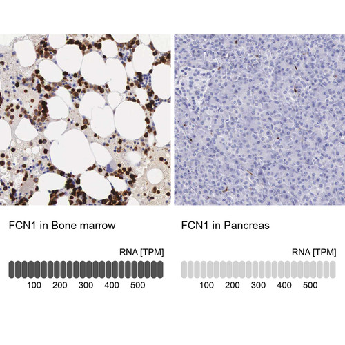 Anti FCN1 pAb [Catalog No.: ATL-HPA000685]