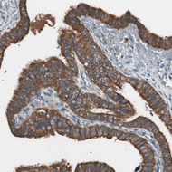 Immunofluorescent staining of human cell line A-431 shows localization to plasma membrane & cytosol.