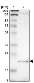 Lane 1: Marker [kDa] 230, 130, 95, 72, 56, 36, 28, 17, 11<br/>Lane 2: Human cell line RT-4
