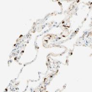 Immunohistochemical staining of human lung shows moderate to strong cytoplasmic positivity in macrophages.
