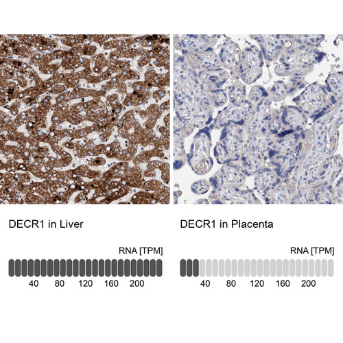 Anti DECR1 pAb [Catalog No.: ATL-HPA023160]