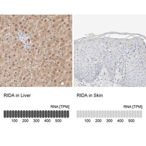 Anti RIDA pAb [Catalog No.: ATL-HPA023489]