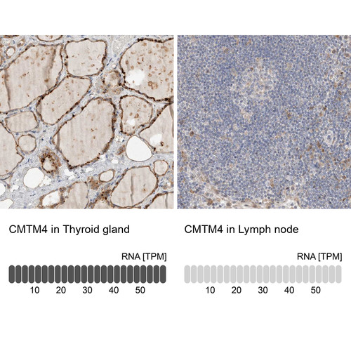 Anti CMTM4 pAb [Catalog No.: ATL-HPA023890]