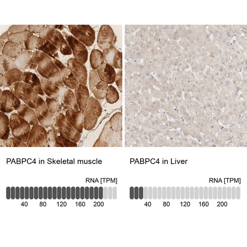 Anti PABPC4 pAb [Catalog No.: ATL-HPA027301]