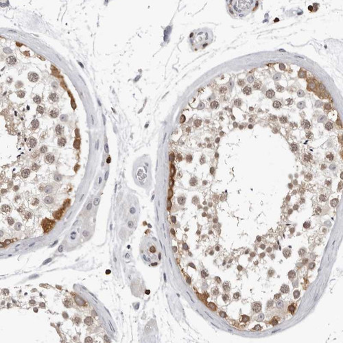 Anti HSPH1 pAb [Catalog No.: ATL-HPA028675]