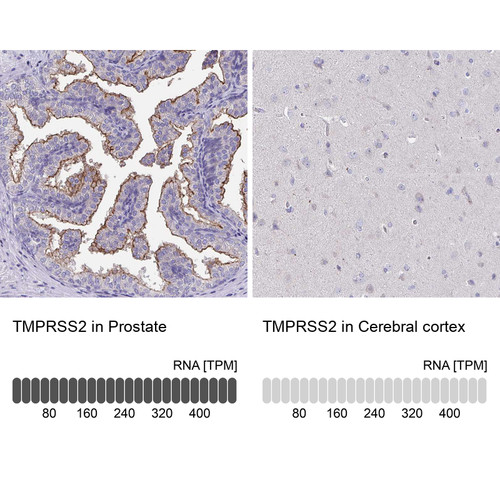 Anti TMPRSS2 pAb [Catalog No.: ATL-HPA035787]