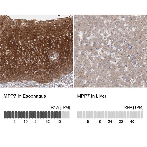 Anti MPP7 pAb [Catalog No.: ATL-HPA037598]