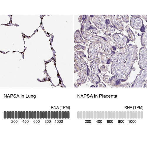 Anti NAPSA pAb [Catalog No.: ATL-HPA047236]