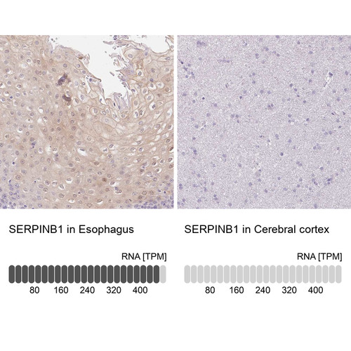 Anti SERPINB1 pAb [Catalog No.: ATL-HPA052642]
