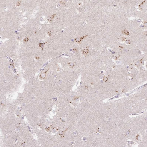Anti ABR pAb [Catalog No.: ATL-HPA054824]