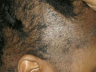Why You Should Not Perm Your Natural Hair