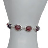 Cherry Amber Sterling Silver Link Bracelet -----