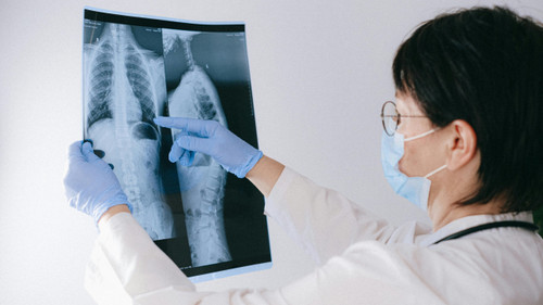 RX 1 Proyección | Affidea