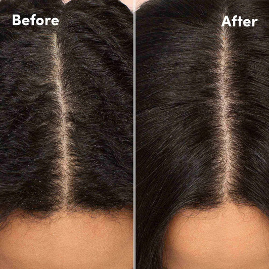 MIZANI Scalp Care Anti-Dandruff Conditioner (16.9 oz)