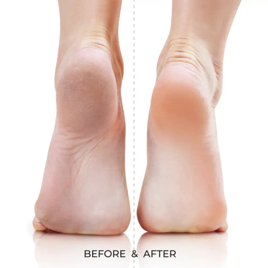 KISS Dual-Sided Quickbuff Foot File